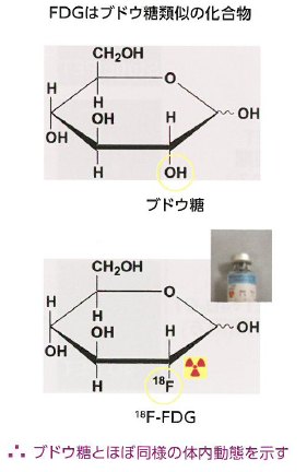 FDGとブドウ糖の違いは一部のみです。