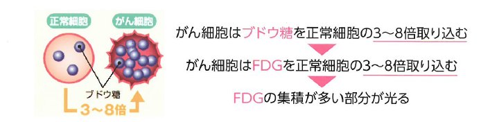 がん細胞が、PET/CTで「光る」理由。